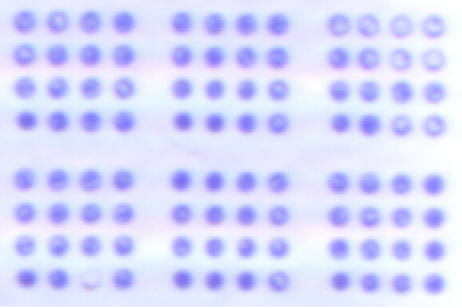Image of doughnut shaped microarray spots